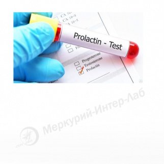 Prolactin II.  Пролактин 100 тестов