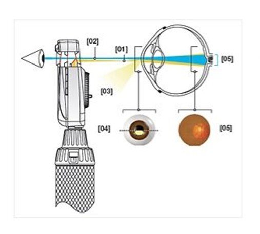 Эксклюзивная асферическая оптическая система (AOS) прямого медицинского офтальмоскопа BETA 200 LED 