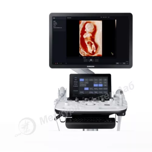 HS40 ультразвуковой сканер Samsung Medison фото 3